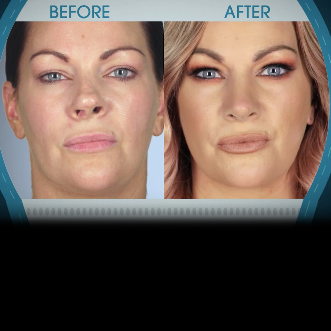 Botched Before & After: See the Most Shocking Transformations - WireFan Botched Before & After: See the Most Shocking Transformations - WireFan